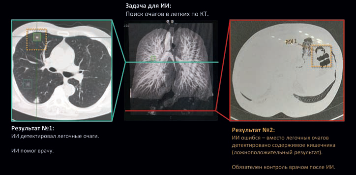 рис04-2